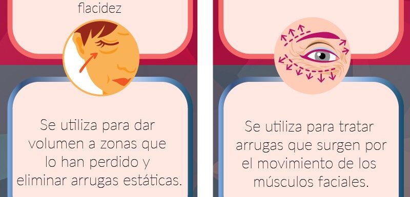 ¿en Qué Se Diferencian El Acídulo Hialurónico Y El Bótox? Dr Amselem