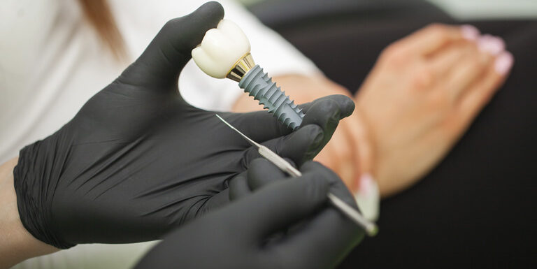 ¿qué Son Los Implantes Dentales? Clínica Dental En Gijón, Beatriz Vega