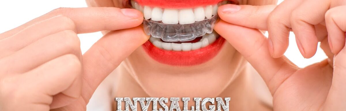 Ortodoncia Invisible, La Ortodoncia Sin Brackets