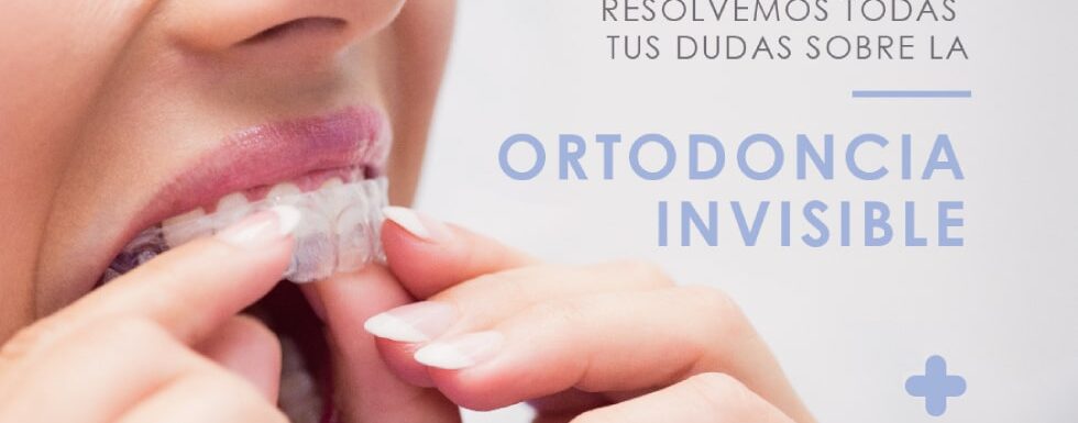 Resolvemos Todas Tus Dudas Sobre La Ortodoncia Invisible